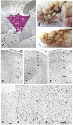 A Radial Glia Fascicle Leads Principal Neurons from the Pallial-Subpallial Boundary into the Developing Human Insula